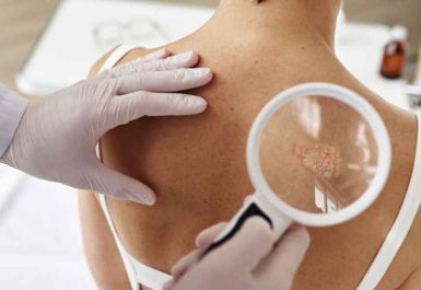 Cancer de la peau avancé : quels symptômes doivent alerter ?-Lu Dong Ming